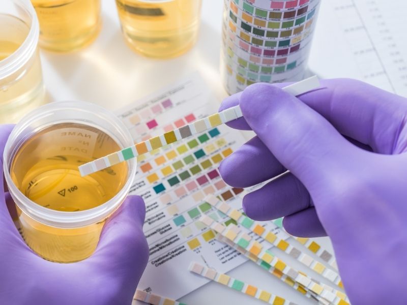 idrar-testlerinde-kan-protein-lokosit-gorulmesi-nedir