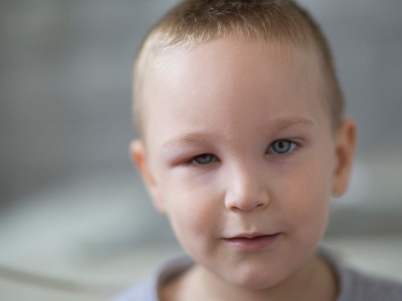 idrar-testlerinde-kan-protein-lokosit-gorulmesi